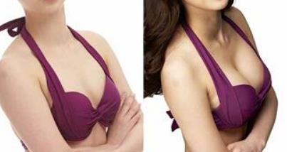 無錫去除祛斑治療價格整理(無錫坤如瑪麗亞整形外科去除祛斑參考價：6806元)