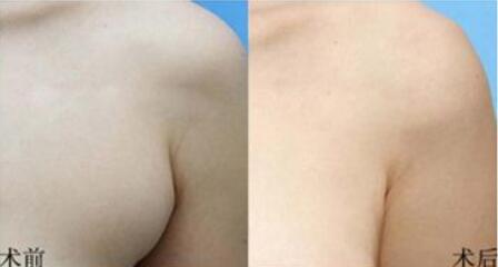 長春面部精雕價(jià)目表明細(xì)(長春劉曉娟美容院面部精雕參考價(jià)：6781元)