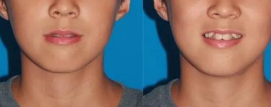 蚌埠三院整形美容中心：醫(yī)生資料、科室特色及價格匯總