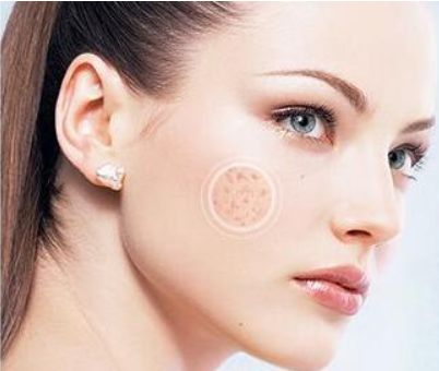 廣州麗港麗格醫(yī)療美容專家團隊及雙眼皮案例分享