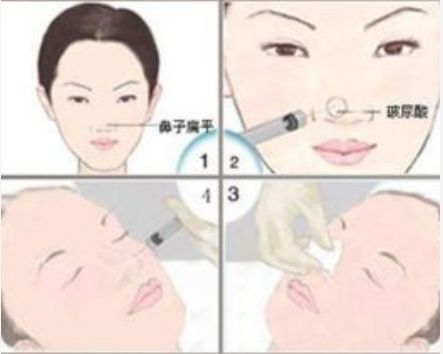 泉州想做吸脂？這些醫(yī)院信息分享給你！