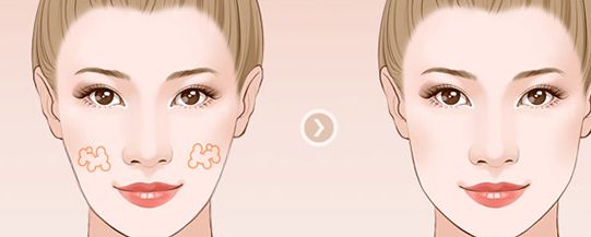 中山大學(xué)附屬醫(yī)院整形美容科怎么樣？專業(yè)技術(shù)解讀與口碑評價