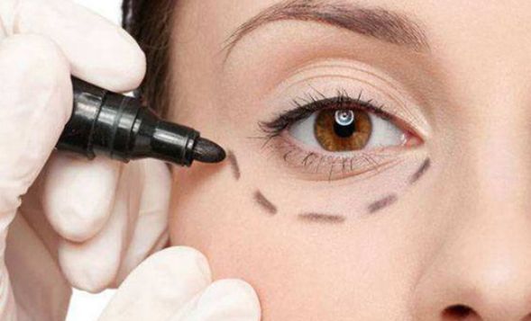 太原隆鼻手術(shù)費(fèi)用多少？華美整形醫(yī)院價(jià)格表參考