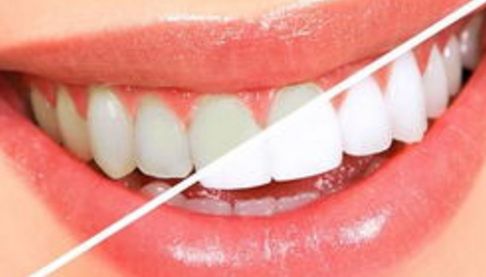 重慶整形醫(yī)院三強：重慶美萊對比華美技術大 pk