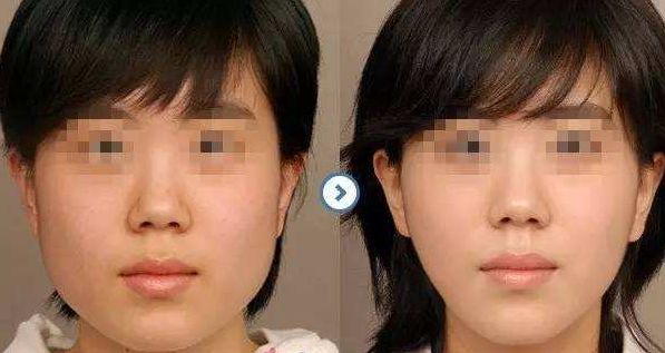 天津河西愛慕芳容醫(yī)學美容門診部：項目介紹及價格一覽