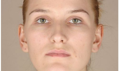 深圳 orthodontic 醫(yī)院推薦：哪家技術(shù)好又靠譜？