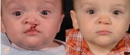 昆明醫(yī)美排行榜：10家醫(yī)院盤點，你需要知道的所有信息