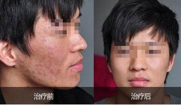 鄭州哪些醫(yī)生能夠進(jìn)行外耳整形手術(shù)？口碑TOP7名單揭曉！