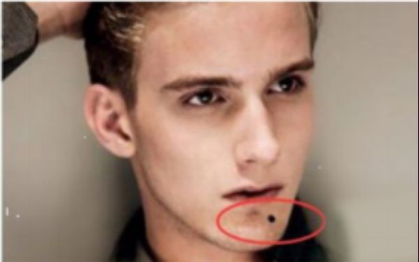 北京協(xié)和整形醫(yī)院專家介紹及真實(shí)案例匯總