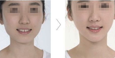 南京嘉怡美吸脂效果好嗎？專家團隊與真實評價分析