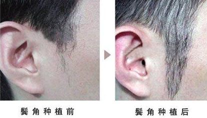 北京加減美整形醫(yī)院：祛皺抗衰大揭秘！