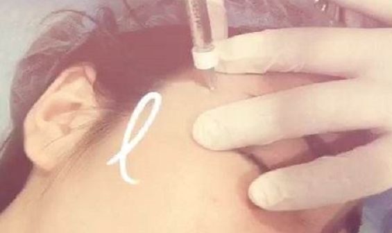 廣州眼袋去除手術(shù)攻略：深度測評熱門醫(yī)生技術(shù)！