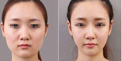 中國十大植發(fā)醫(yī)院盤點(diǎn)：實(shí)力認(rèn)證、口碑出眾、價(jià)格合理