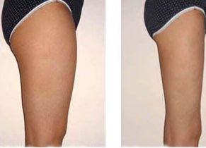 吃出無暇?。罕P點(diǎn)日常平價祛斑食物清單