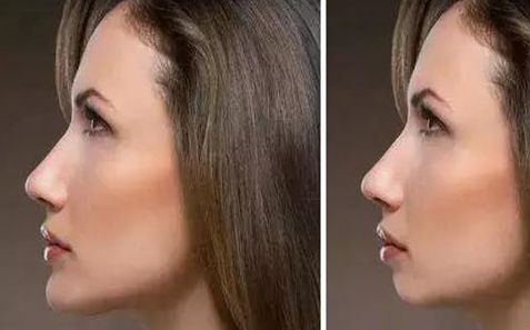 杭州割雙眼皮整形醫(yī)院實(shí)力排名前十公布