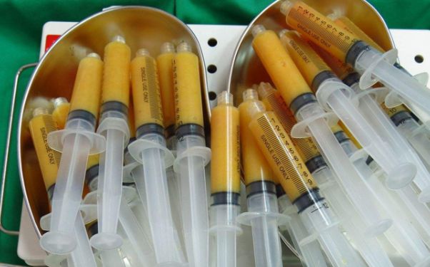 最新雙眼皮去除技術(shù)無刀無痕？手機電腦輕松找回雙眼大亮